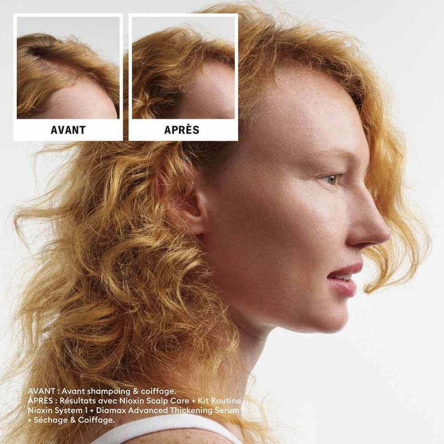 Nioxin System 1 Natural Hair Loss Kit 700 мл: цены и характеристики