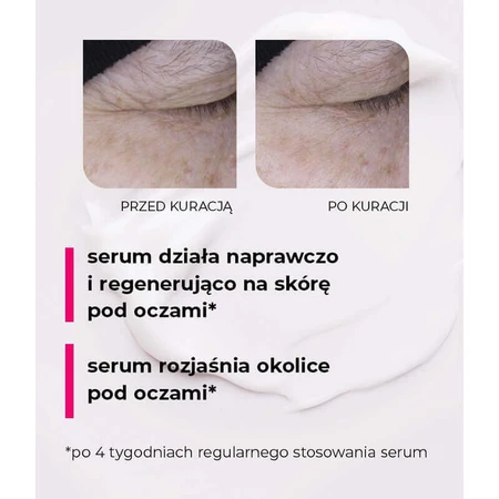 Veoli Botanica 20 Seconds Magic Eye Treatment, сироватка для ліфтингу та відновлення шкіри навколо очей і повік, 15 мл: ціни та характеристики