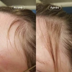 Omum Mon Coup de Pousse Nutricosmétique 60 капсул: ціни та характеристики