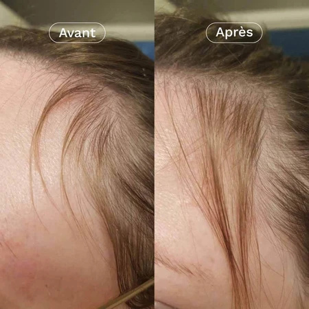 Omum Mon Coup de Pousse Nutricosmétique 60 капсул: ціни та характеристики
