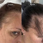 Omum Mon Coup de Pousse Nutricosmétique 60 капсул: ціни та характеристики