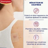 Зменшувач рубців Elastoplast x21