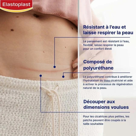Зменшувач рубців Elastoplast x21: ціни та характеристики