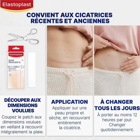 Зменшувач рубців Elastoplast x21: ціни та характеристики