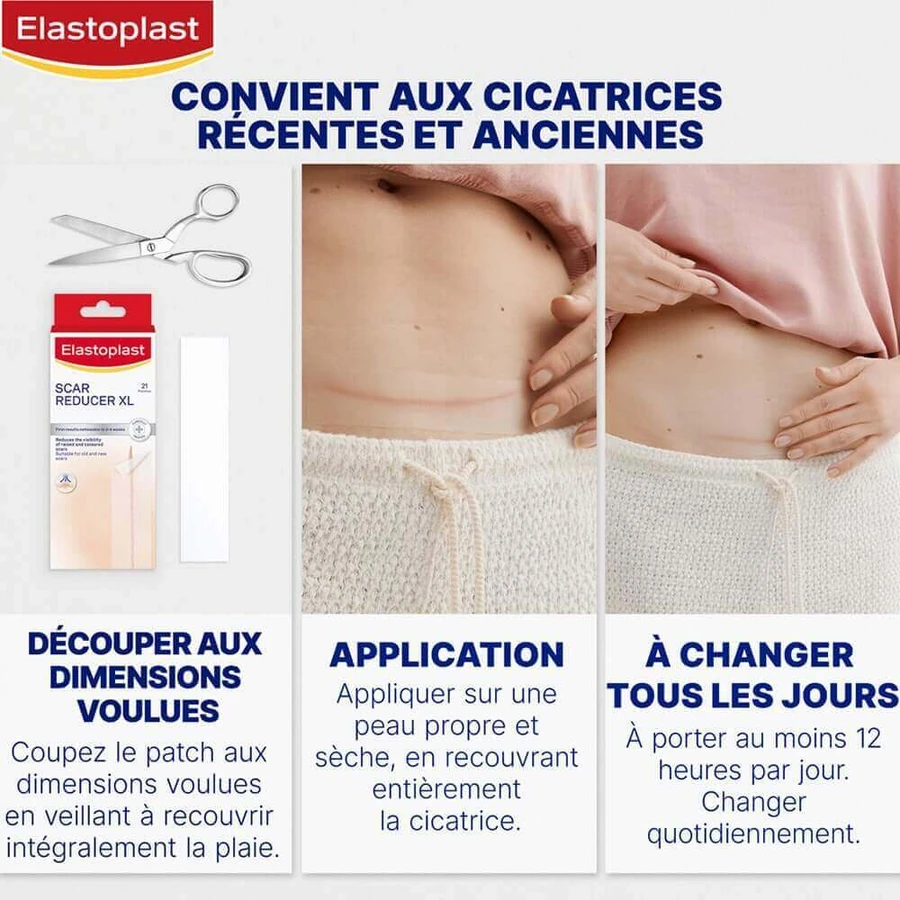 Зменшувач рубців Elastoplast x21: ціни та характеристики