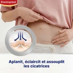 Зменшувач рубців Elastoplast x21: ціни та характеристики