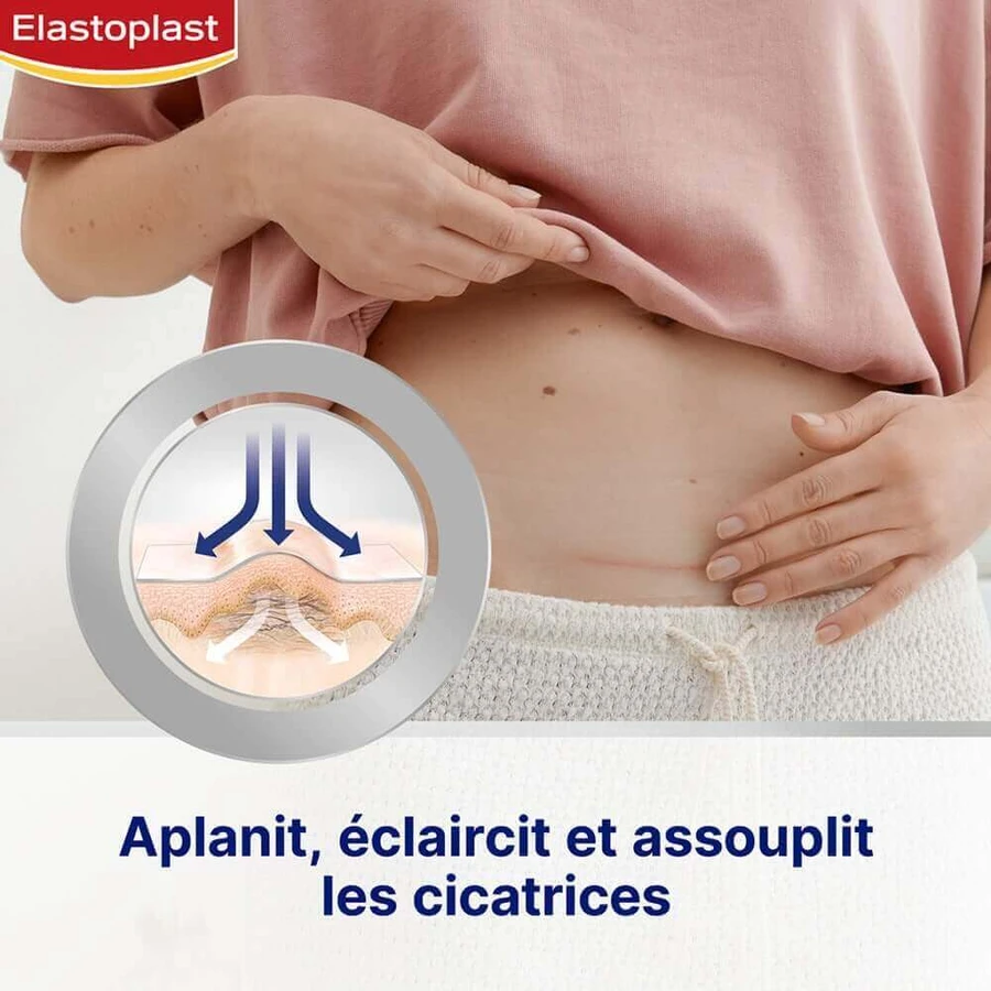 Зменшувач рубців Elastoplast x21: ціни та характеристики