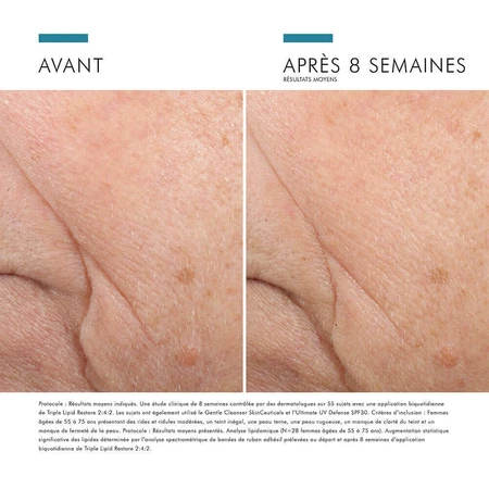 Skinceuticals Correct Triple Lipid Restore 2:4:2 48 мл: ціни та характеристики