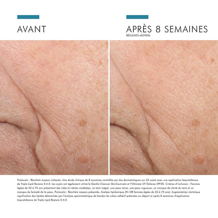 Skinceuticals Correct Triple Lipid Restore 2:4:2 48 мл: ціни та характеристики