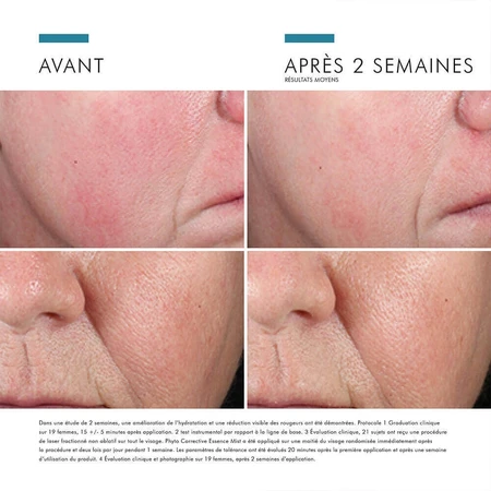 Skinceuticals Phyto Corrective Essence Mist Заспокійливий туман для чутливої шкіри 50 мл: ціни та характеристики
