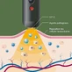 Arkopharma Herpotherm Neo Warming Pen Лечение герпеса лабиалис и лихорадочных волдырей