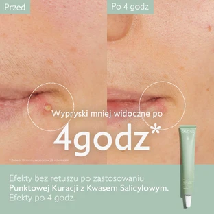 Caudalie Vinopure, tratament pentru pete cu acid salicilic, 15 мл