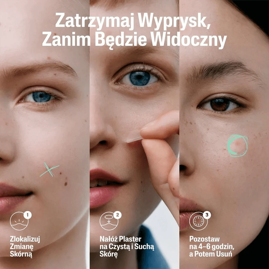 Набір для очищення та догляду Cetaphil EM, Міцелярна емульсія для чутливої шкіри, для всієї родини, 250 мл + точкові пластирі від екземи, 24 шт.: ціни та характеристики