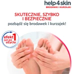 Засіб від бородавок та аденом на шкірі Help4Skin, 50 мл: ціни та характеристики
