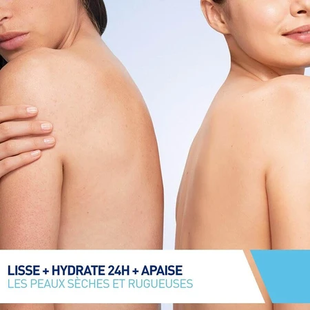 Cerave Body SA Разглаживающий крем 10% мочевины и салициловой кислоты для сухой кожи 177 мл: цены и характеристики