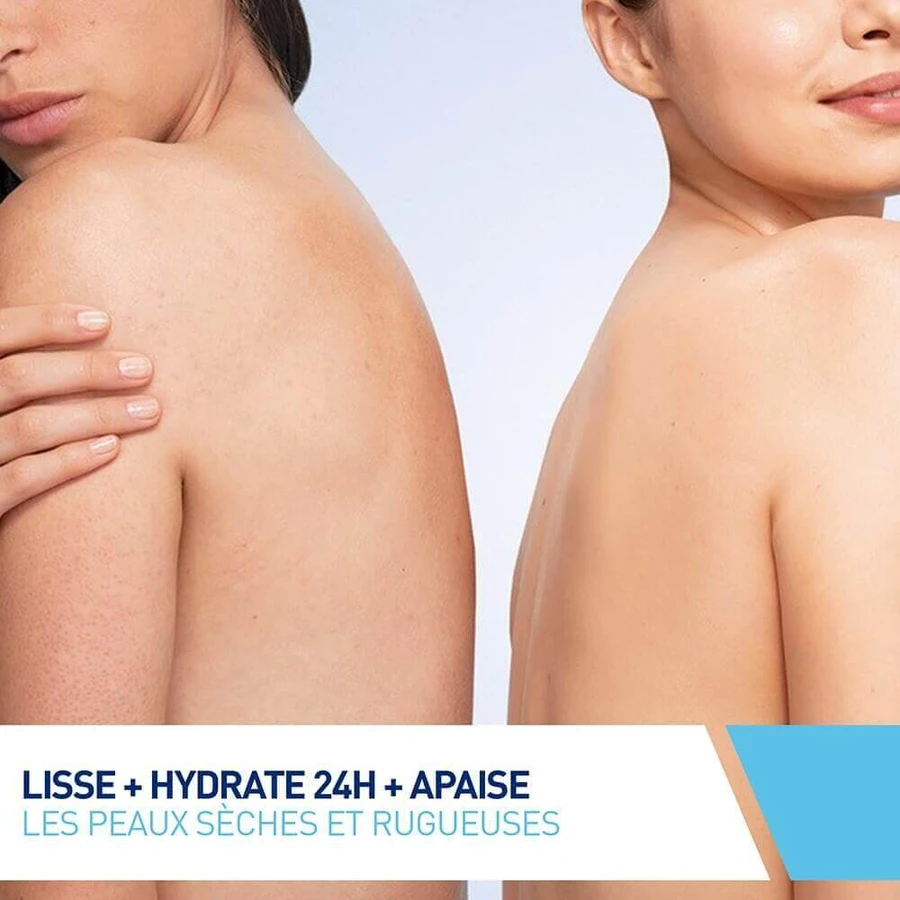 Cerave Body SA Разглаживающий крем 10% мочевины и салициловой кислоты для сухой кожи 177 мл: цены и характеристики