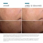 Skinceuticals Discoloration Defense Serum Visage Serum Anti Taches Brunes 30ml: цены и характеристики