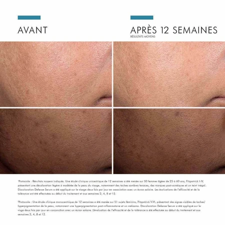 Skinceuticals Discoloration Defense Serum Visage Serum Anti Taches Brunes 30ml: цены и характеристики