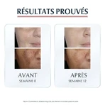 Антипігментна сироватка Eucerin Duo 30 мл: ціни та характеристики