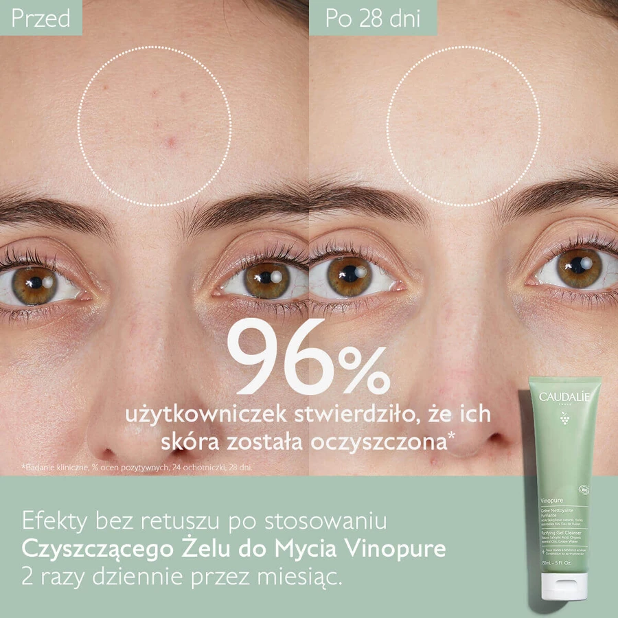 Caudalie Vinopure, гель для ухода за кожей лица, 150 мл: цены и характеристики