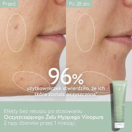 Caudalie Vinopure, гель для ухода за кожей лица, 150 мл: цены и характеристики