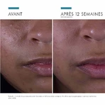 Skinceuticals Сироватка для обличчя Silymarin CF проти недосконалостей 30 мл: ціни та характеристики