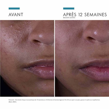 Skinceuticals Сироватка для обличчя Silymarin CF проти недосконалостей 30 мл: ціни та характеристики