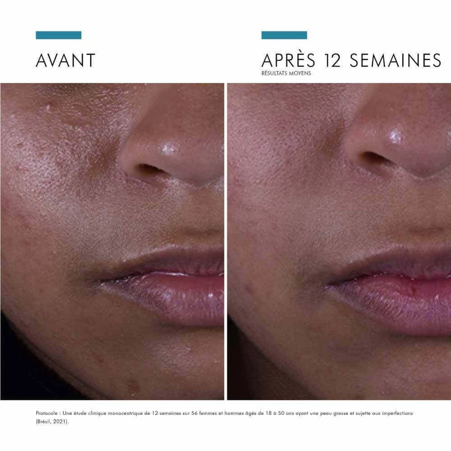 Skinceuticals Сироватка для обличчя Silymarin CF проти недосконалостей 30 мл: ціни та характеристики