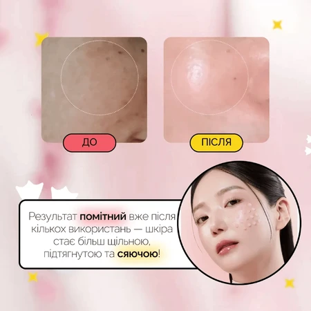 Cыворотка для лица Medicube PDNR Pink Collagen Exosome Shot 7500, регенерирующая, 30 мл: цены и характеристики