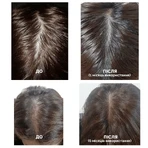 Шампунь Dr.FORHAIR Folligen Shampoo, укрепляющий, против выпадения волос, 500 мл : цены и характеристики