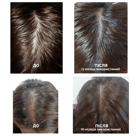 Шампунь Dr.FORHAIR Folligen Shampoo, укрепляющий, против выпадения волос, 500 мл : цены и характеристики