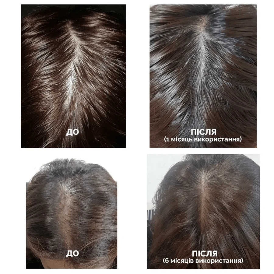 Шампунь Dr.FORHAIR Folligen Shampoo, укрепляющий, против выпадения волос, 500 мл : цены и характеристики