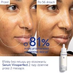 Caudalie Vinoperfect сыворотка для осветления пятен, 50 мл: цены и характеристики