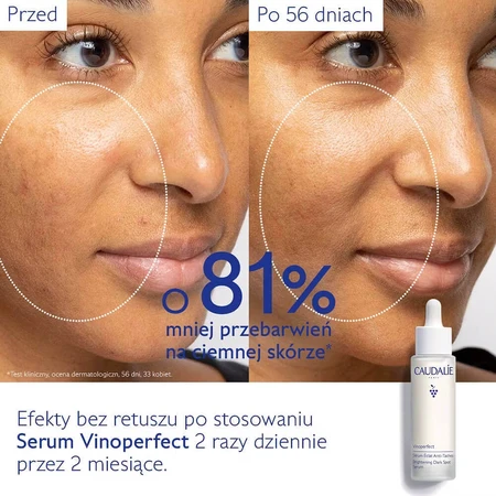 Caudalie Vinoperfect сыворотка для осветления пятен, 50 мл: цены и характеристики