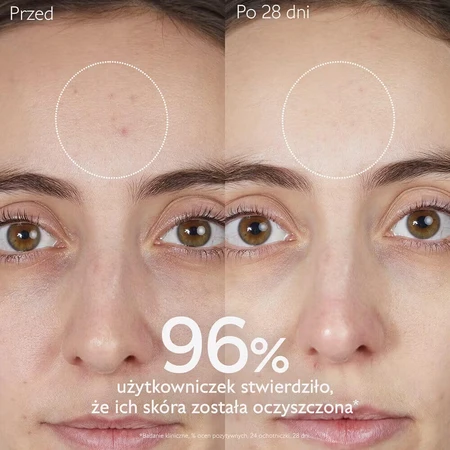 Caudalie Vinopure, гель для вмивання обличчя, що очищає, для шкіри, схильної до акне, 75 мл: ціни та характеристики