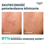 Eucerin DermoPure Clinical Peeling 10, отшелушивающее и разглаживающее средство для кожи, склонной к акне, 40 мл: цены и характеристики