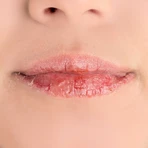 Allergica, бальзам для губ, 15 мл: цены и характеристики