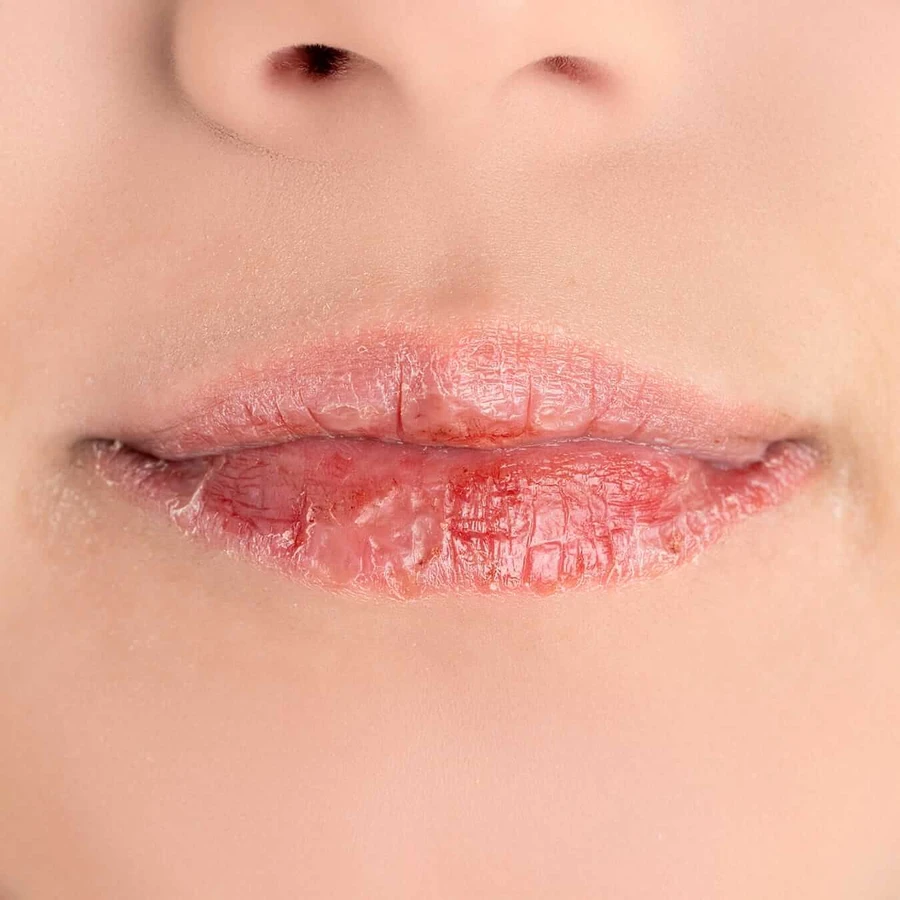 Allergica, бальзам для губ, 15 мл: цены и характеристики