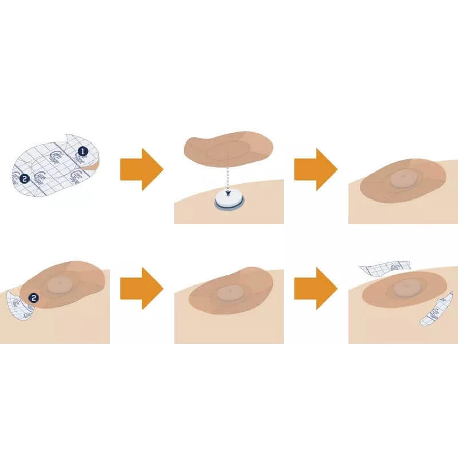 Сенсорные пластыри CureTape, сенсорные пластыри CGM для мониторинга уровня глюкозы, микс цветов, 8 штук: цены и характеристики