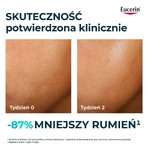 Eucerin DermoPure Clinical Hydra Repair, заспокійливий крем для шкіри, схильної до акне, 40 мл: ціни та характеристики