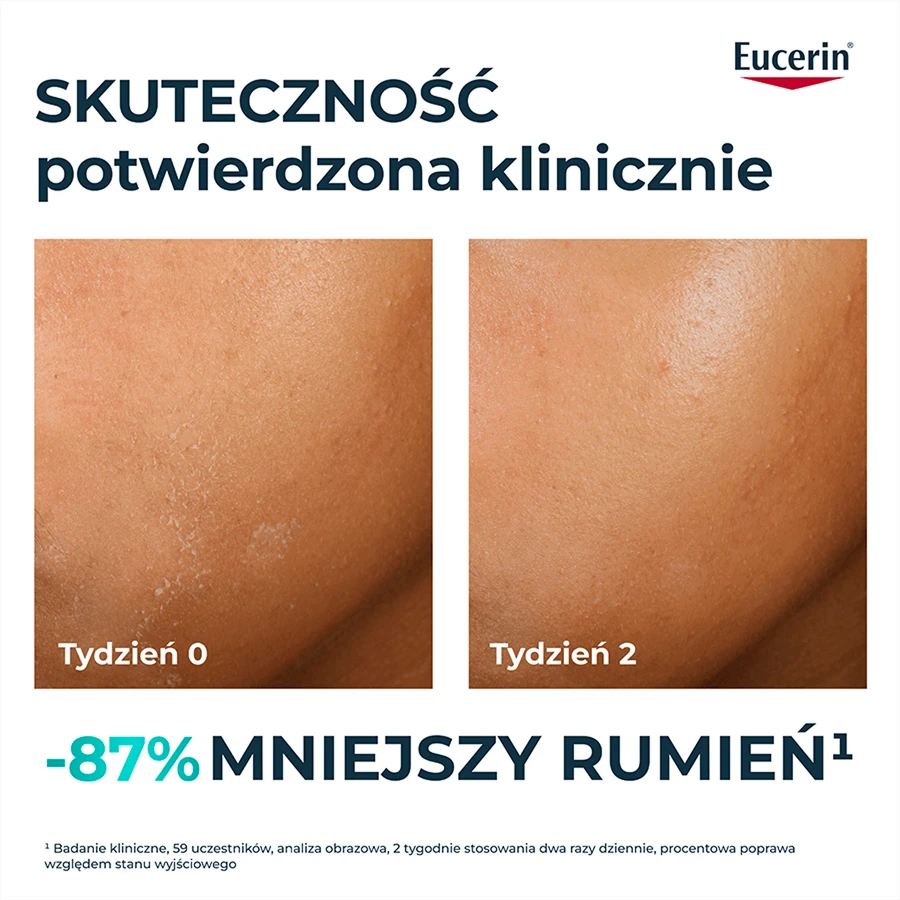 Eucerin DermoPure Clinical Hydra Repair, заспокійливий крем для шкіри, схильної до акне, 40 мл: ціни та характеристики