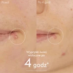 Caudalie Vinopure, точкова обробка з саліциловою кислотою, 15 мл: ціни та характеристики