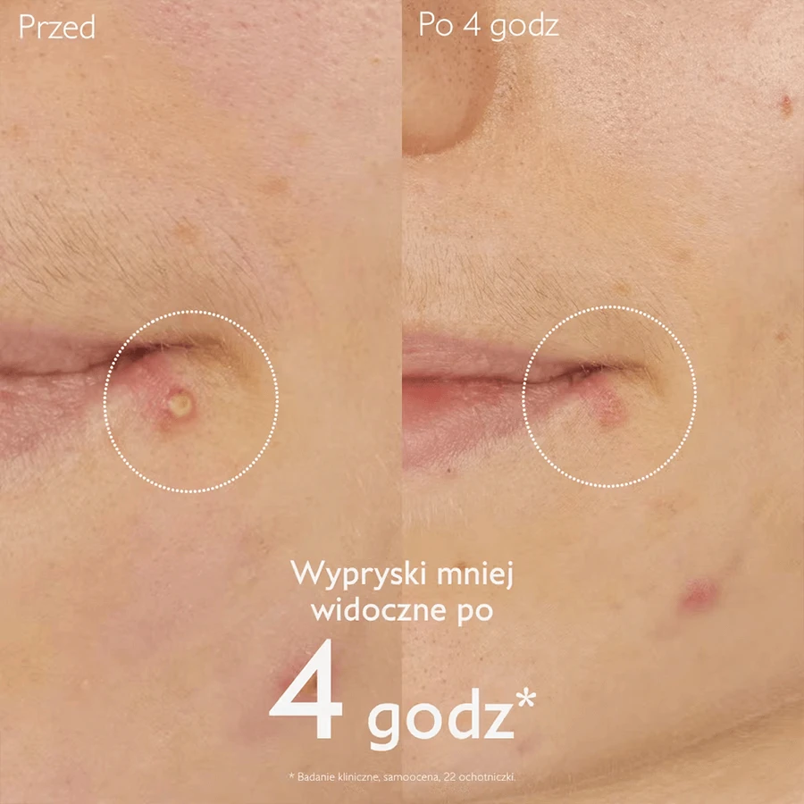 Caudalie Vinopure, точкова обробка з саліциловою кислотою, 15 мл: ціни та характеристики