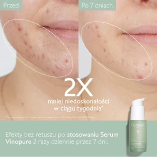 Caudalie Vinopure, сыворотка с салициловой кислотой против несовершенств, 30 мл