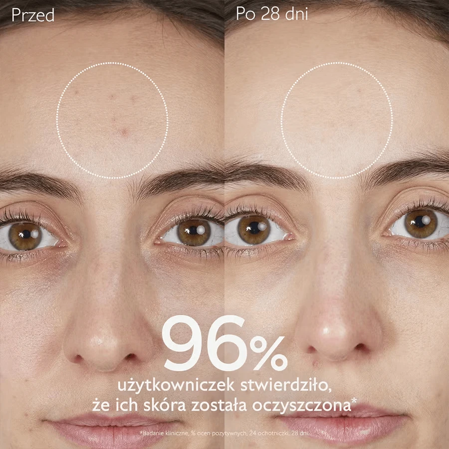 Caudalie Vinopure, очищающий гель для лица, для кожи, склонной к акне, 150 мл: цены и характеристики