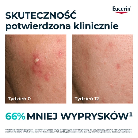 Eucerin DermoPure Clinical Triple Action, сыворотка тройного действия для жирной и склонной к акне кожи, 40 мл: цены и характеристики