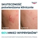 Eucerin DermoPure Clinical Triple Action, сироватка потрійної дії для жирної та схильної до акне шкіри, 40 мл