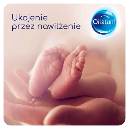Набір Oilatum Advanced Formula, емульсія для ванн, з 1 дня життя, 2 х 250 мл + крем, суха шкіра, дуже суха, схильна до атопії та алергії, 150 г за 1 копійку: ціни та характеристики