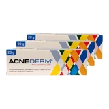 Acne-Derm крем проти акне, азелаїнова кислота 20%, 3х20 г, Union