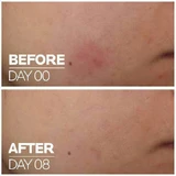La Roche Posay Cicaplast B5 Увлажняющая сыворотка для лица с центеллой азиатской и витамином B5 30 мл
